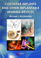 Cochlear Implants and Other Implantable Hearing Devices